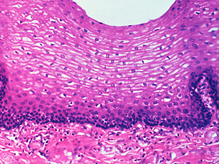Esophageal mucosa