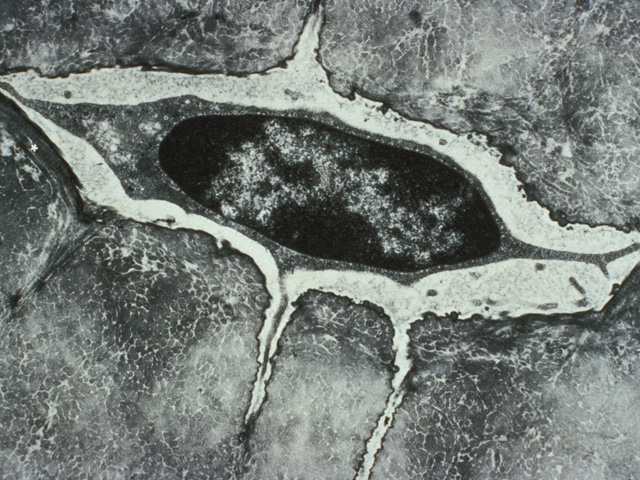 Osteocyte in compact bone