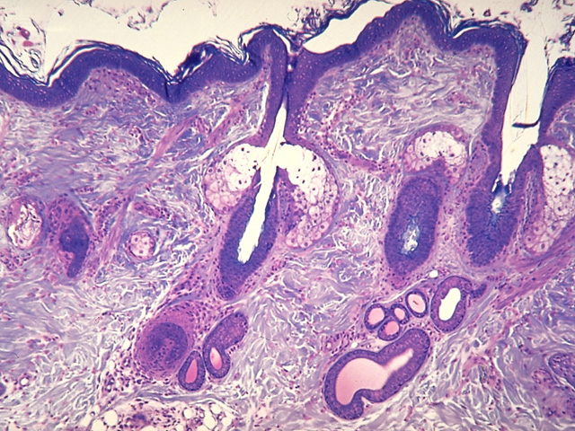 hair follicle under microscope